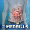 com.archiemd.emt_pt2.abdominal_emergencies