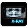 com.ontcorp166.dentalxray
