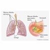 manalsoft.com.cysticfibrosis6